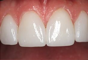 Manhattan Dental Associates | Implant Dentistry, Teeth Whitening and Dental Bridges