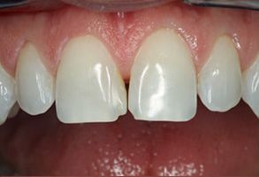 Manhattan Dental Associates | Periodontal Treatment, Implant Dentistry and Dental Bridges